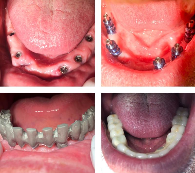 Clínica CV Dental