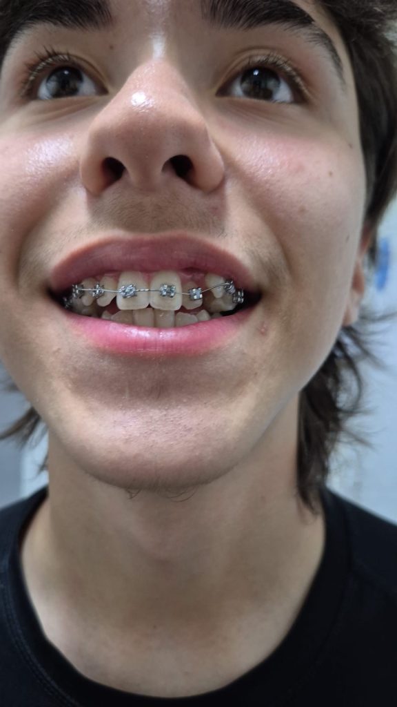 3e7fa77d-3179-4bab-9845-9956bb6b4d12-576x1024 (1)