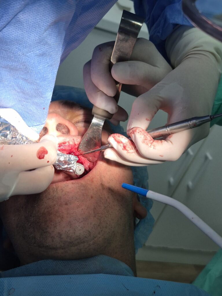 de416627-868d-4194-911c-0592fb62d02c